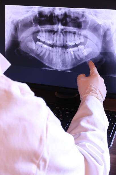 Best Emergency Dental Extractions in Shady Shores, TX