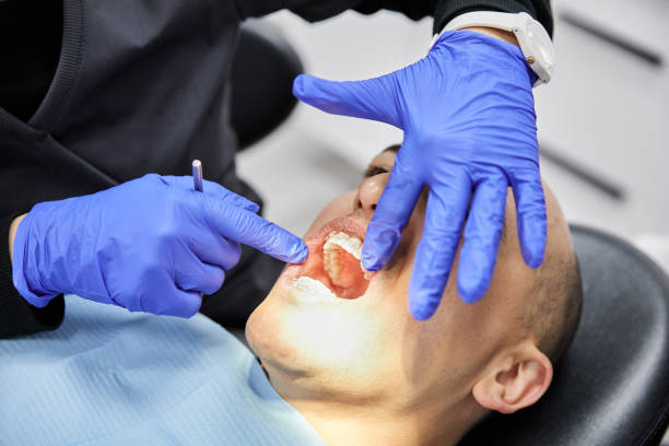 Best Emergency Dental Extractions in Shady Shores, TX