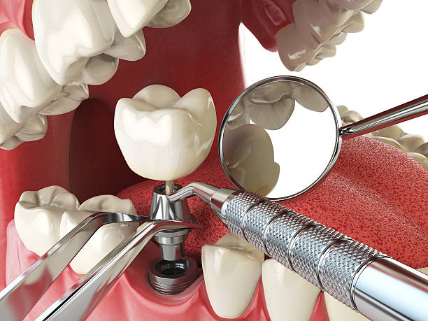 Best Broken or Cracked Tooth Emergency Dentist in Shady Shores, TX