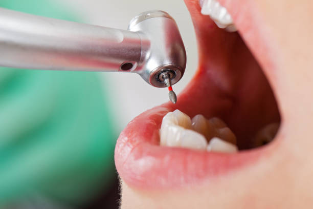 Best Weekend Emergency Dentist in Shady Shores, TX